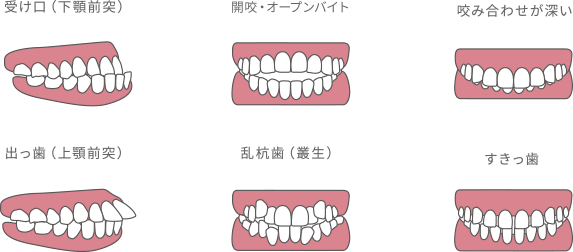 歯並び噛み合わせからお口を健康に